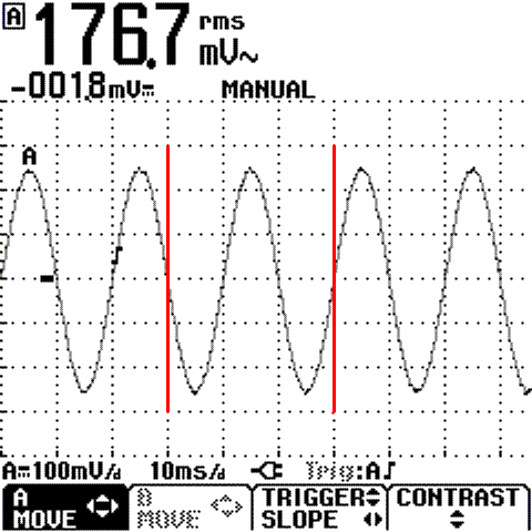 sinus2.GIF